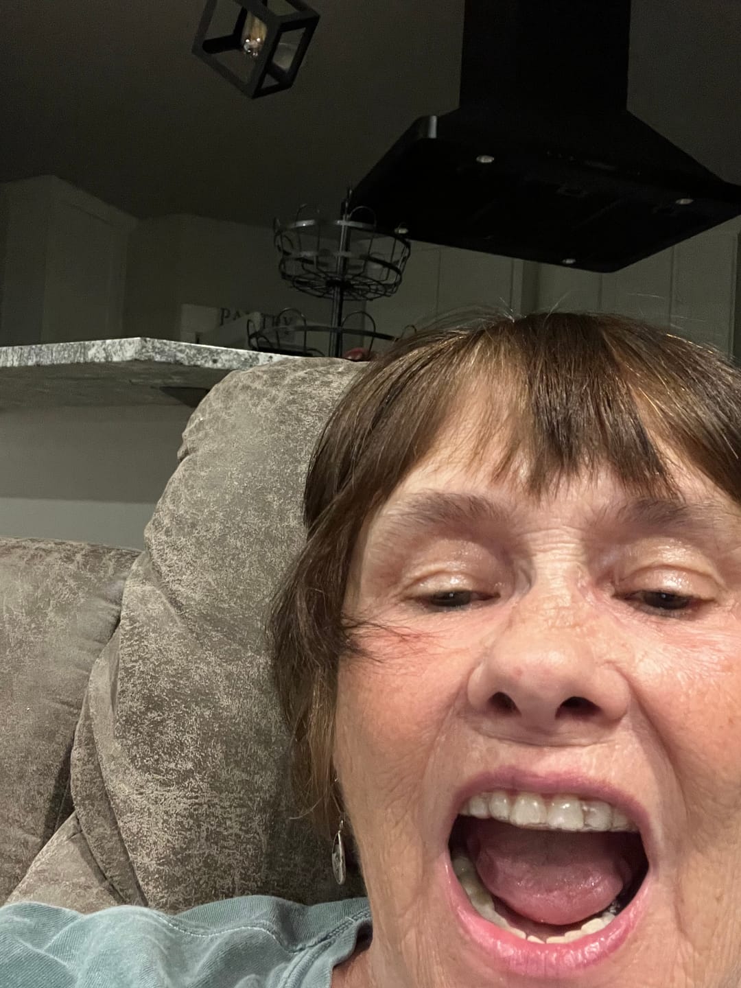 Customer photo review of Clear Custom Night Guard
