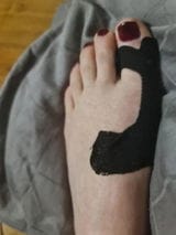 Customer photo review of OrthoFlex™ – Fita para Hálux Valgo