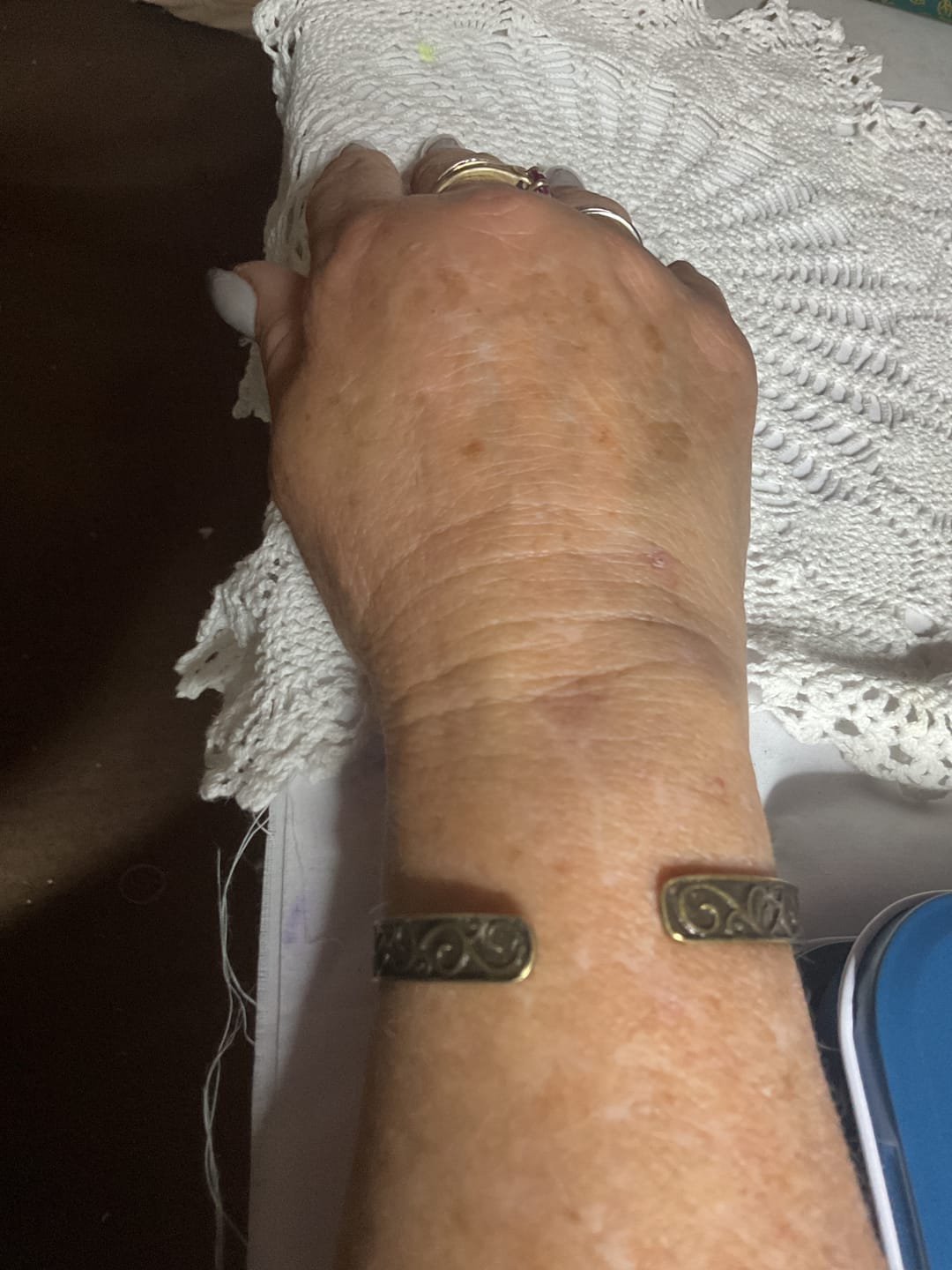 Customer photo review of Organic Tallow Balm