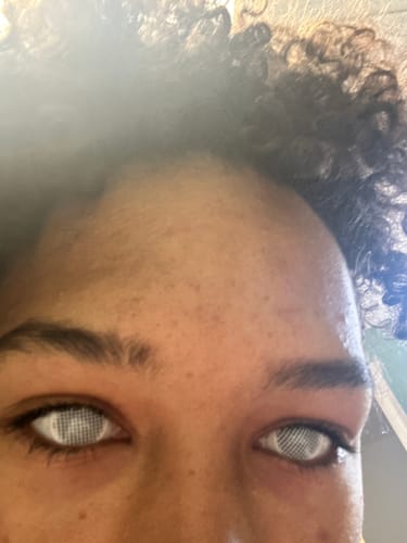 Customer photo review of Cartoon Pattern Clear Contact Lens Case