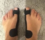 Customer photo review of OrthoFlex™ – Fita para Hálux Valgo