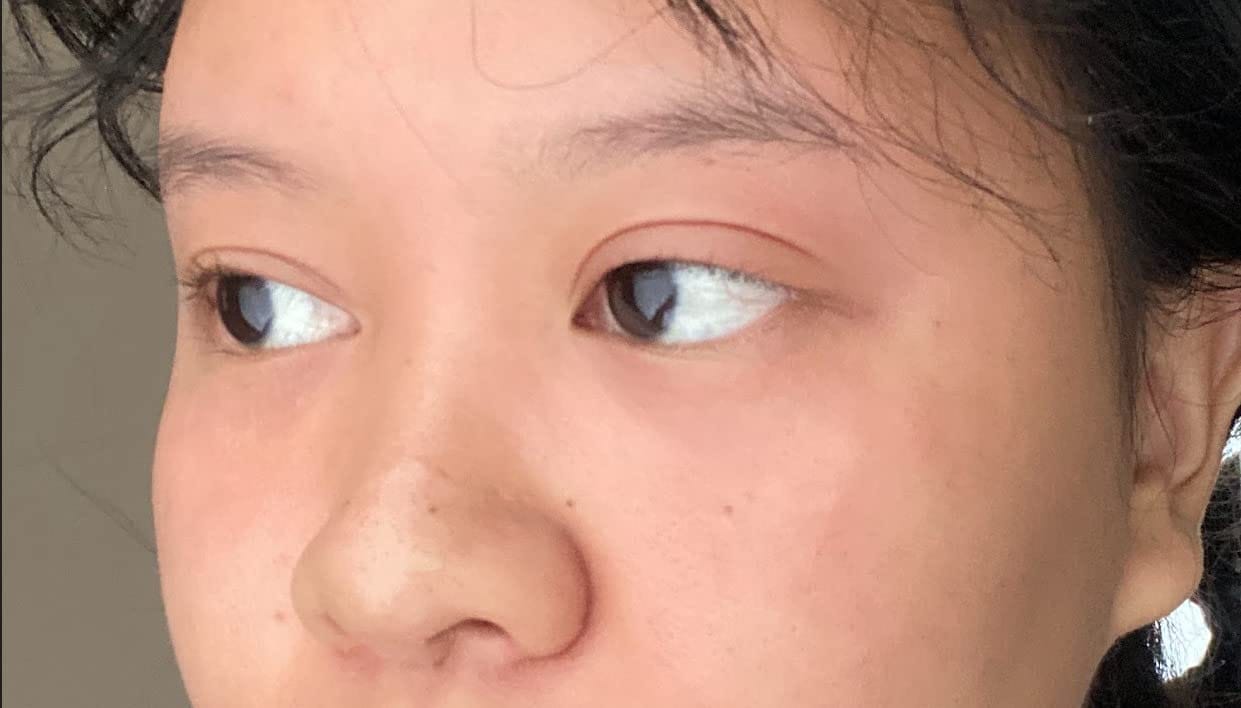 Customer photo review of SOME BY MI Triple Action Eye Cream