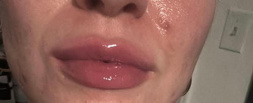 Customer photo review of Voluminizador de Labios – Efecto Inmediato