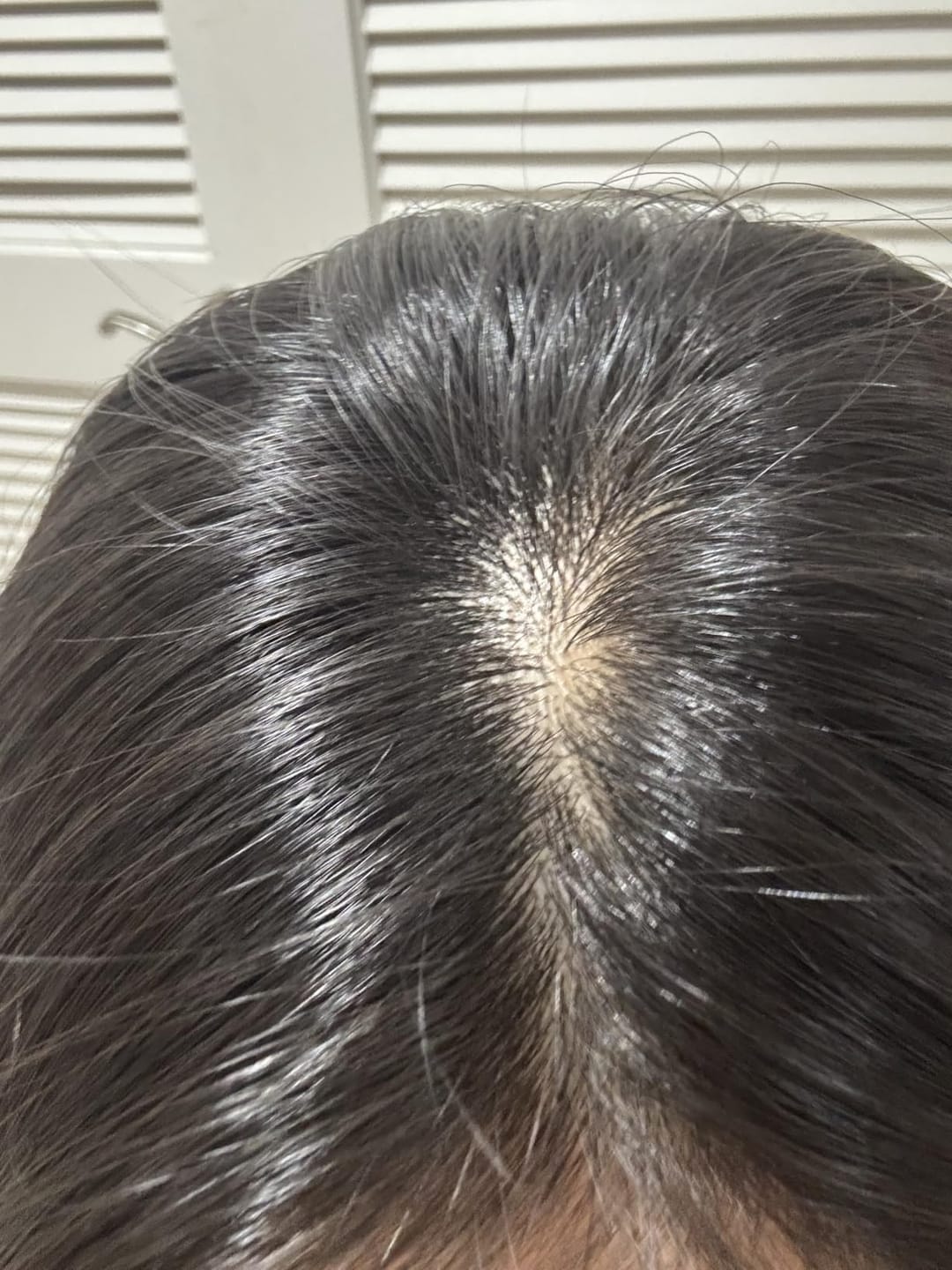 Customer photo review of Koreas #1 Hair Growth Serum