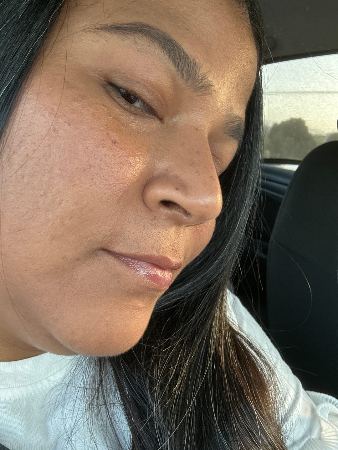 Customer photo review of A CONTROL - ACNÉ HORMONAL & RESISTENCIA A LA INSULINA