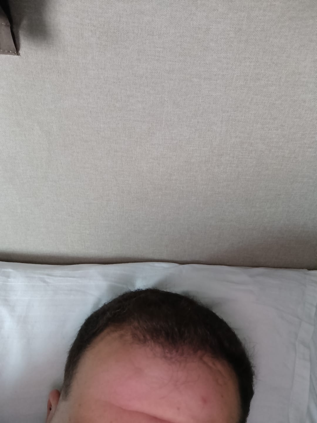 Customer photo review of Flxhair Saç tozu