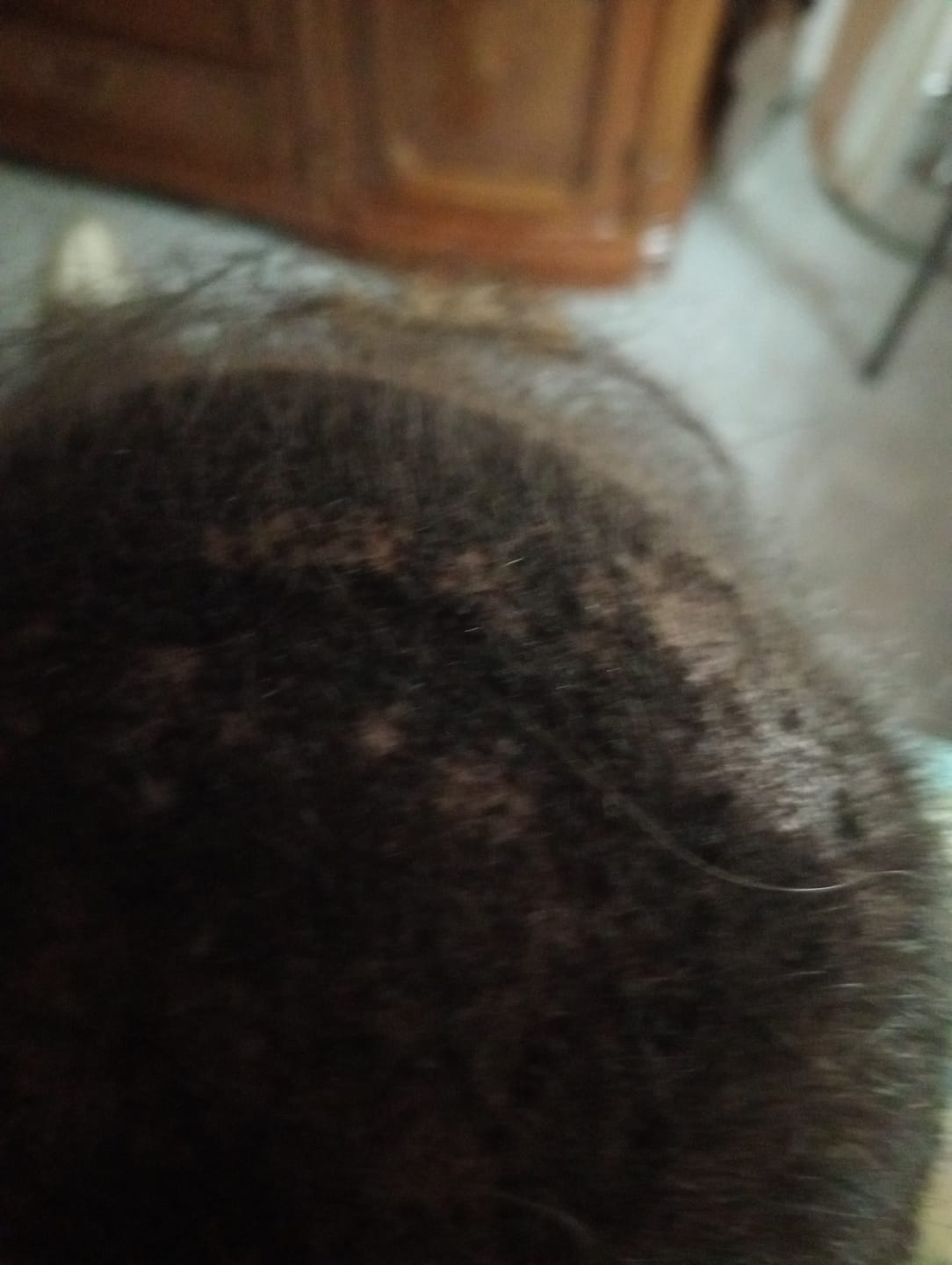 Customer photo review of HairFiberPlus – Fibre di Cotone per Capelli 27,5g | Castano Scuro | Copri Diradamento (~60 giorni)