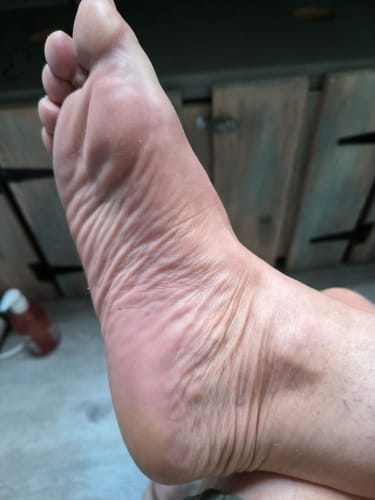 Customer photo review of ALMALILA™ Lima Eléctrica – Pies Suaves y Lisos
