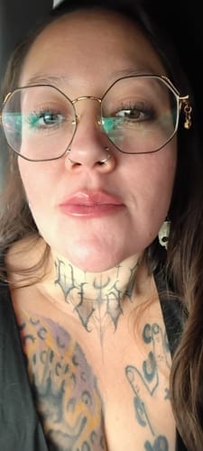Customer photo review of Voluminizador de Labios – Efecto Inmediato