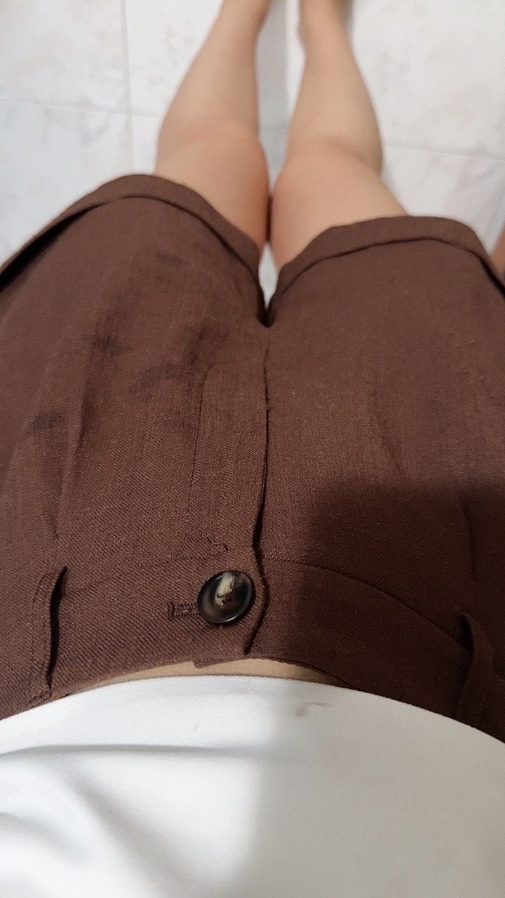 Customer photo review of Double Pleated Linen Waistband Shorts with Cuffed Hem