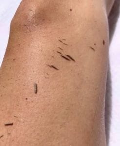 Customer photo review of SoftTouch™ – Peeling-Handschuh