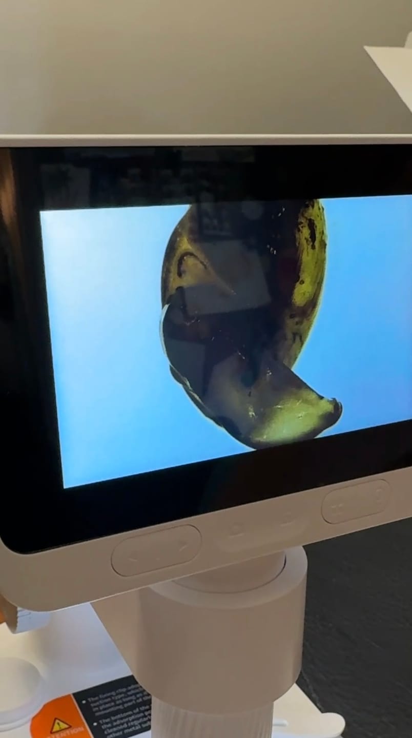 Customer photo review of BeaverLAB Darwin M2 Digital Microscope