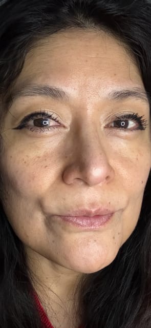 Customer photo review of Madeca Cream Best Duo