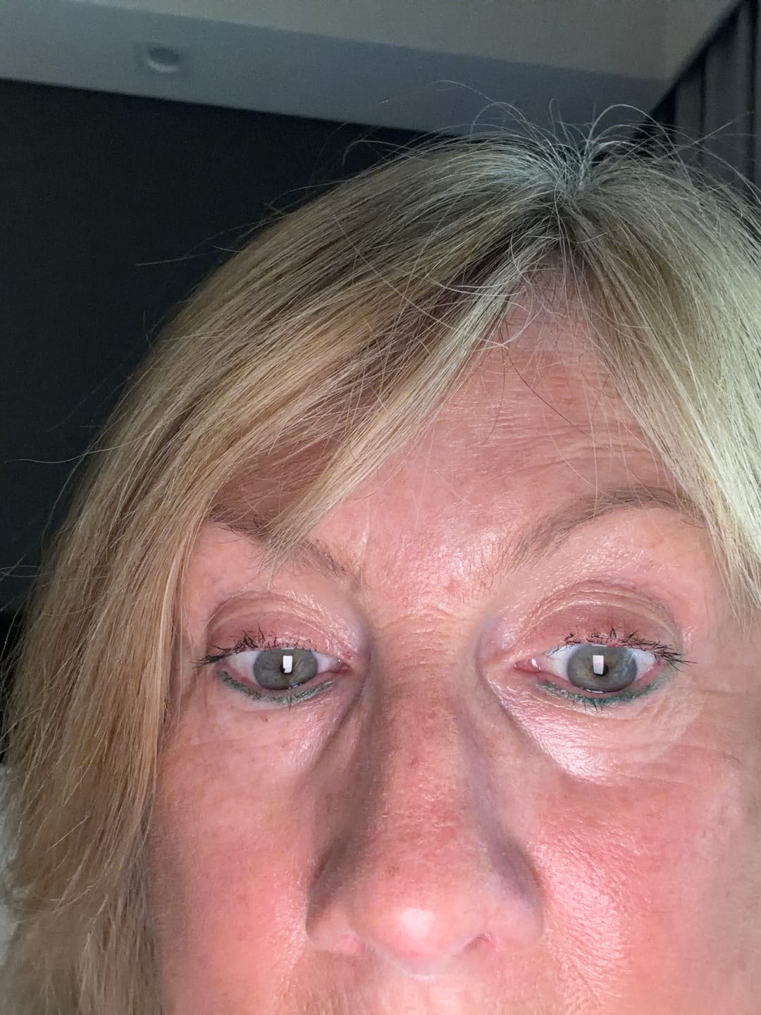 Customer photo review of Eyelash Serum