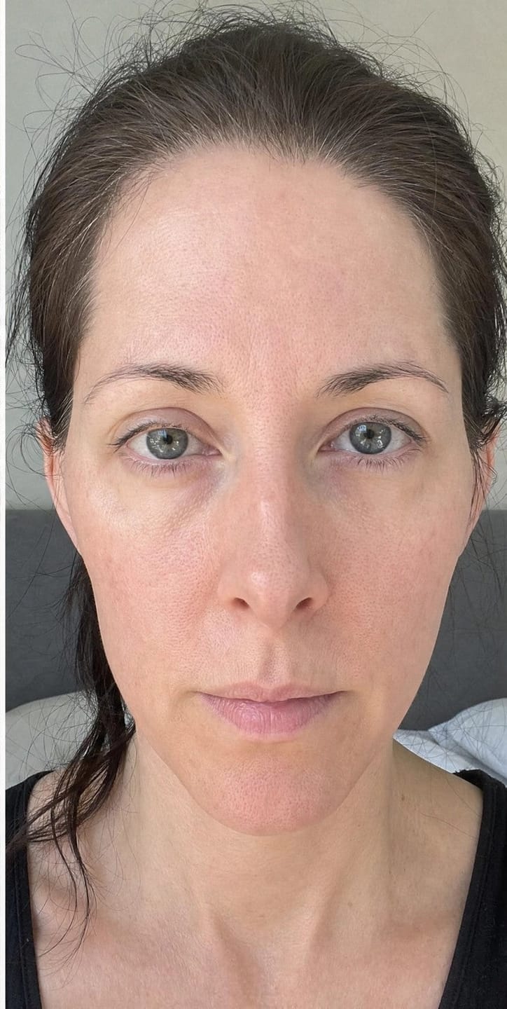 Customer photo review of NuevoSignature Lila Serum 50 ml