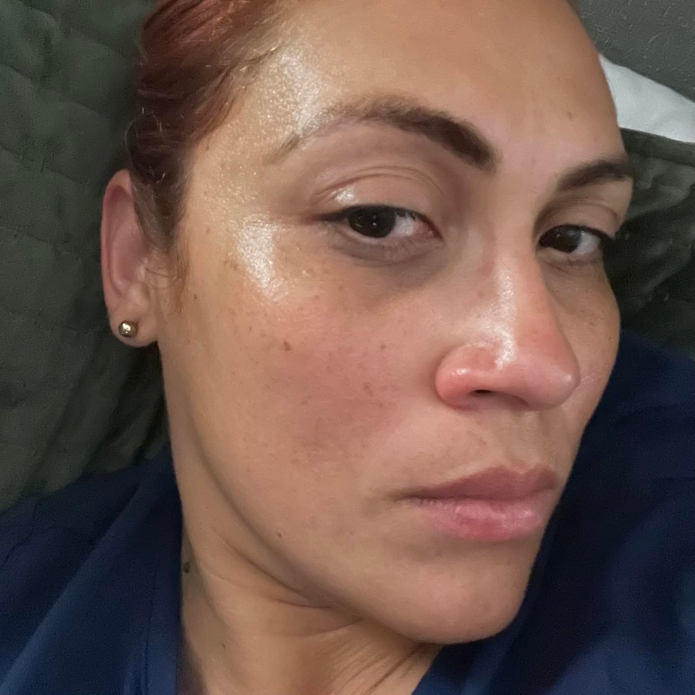 Customer photo review of Arencia Vitamin C Booster Shot