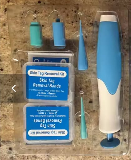 Customer photo review of Kit Elimina Verrugas