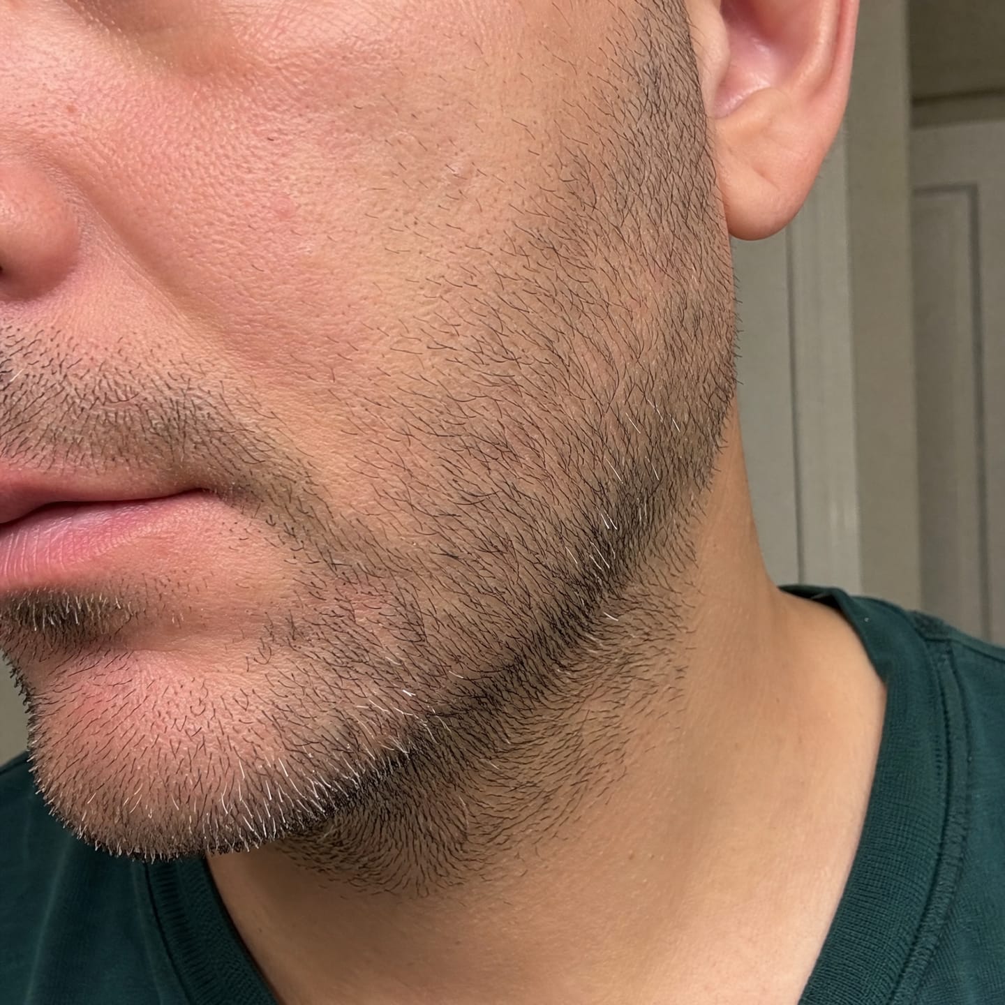 Customer photo review of Dr. Pen  M8