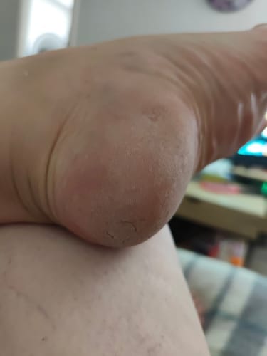 Customer photo review of ALMALILA™ Lima Eléctrica – Pies Suaves y Lisos