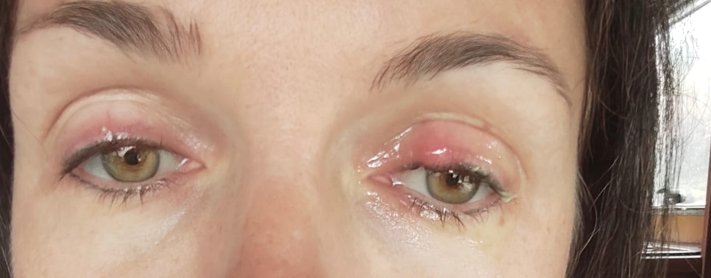 Customer photo review of LASHCOCA!NE - Wimpernserum