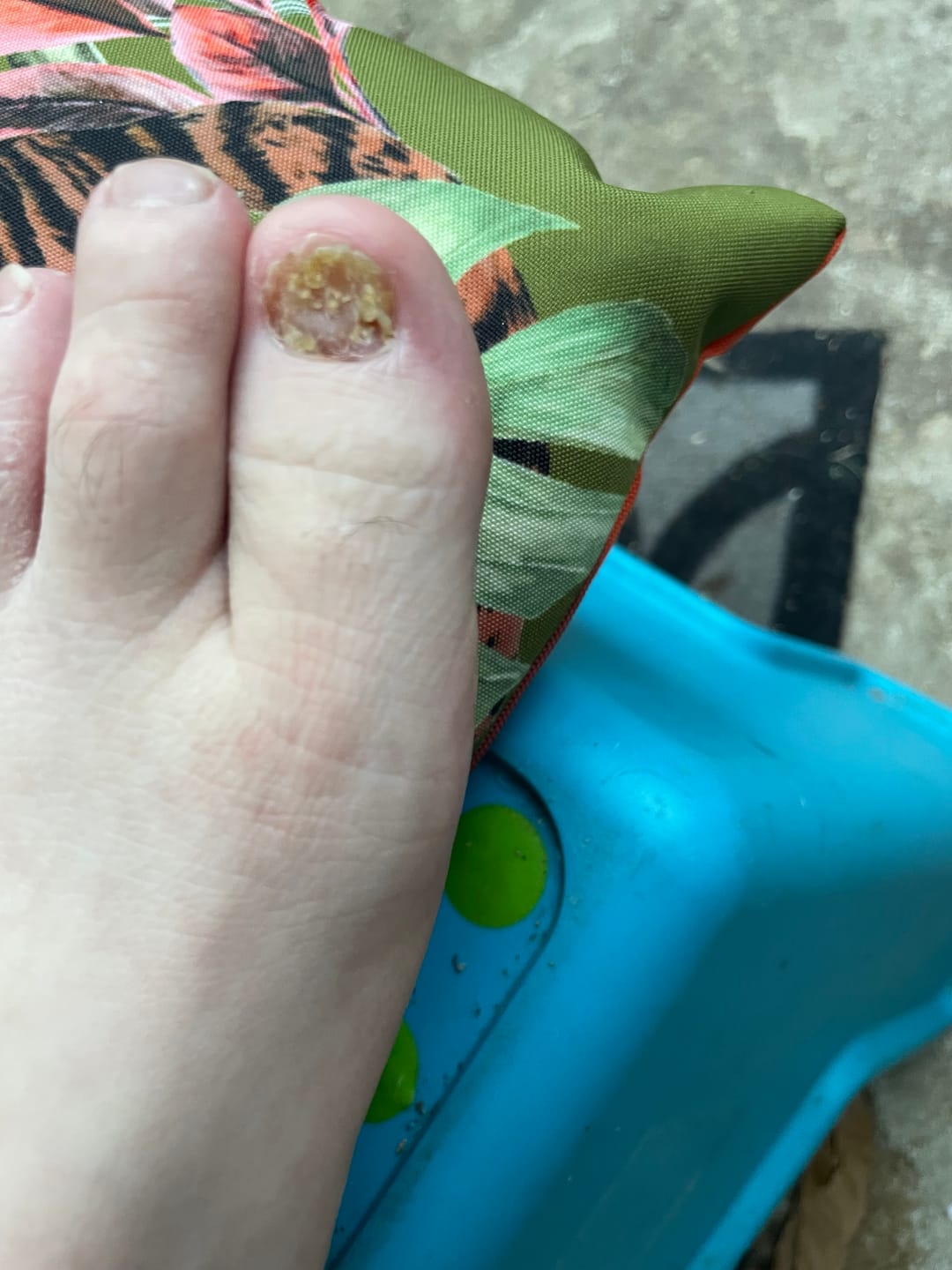 Customer photo review of Fungal Freedom