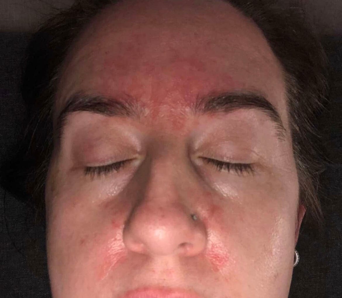 Customer photo review of Seb Natural Calming Serum