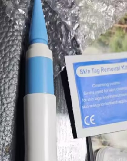 Customer photo review of Kit Elimina Verrugas