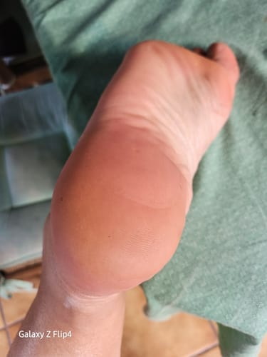 Customer photo review of ALMALILA™ Lima Eléctrica – Pies Suaves y Lisos