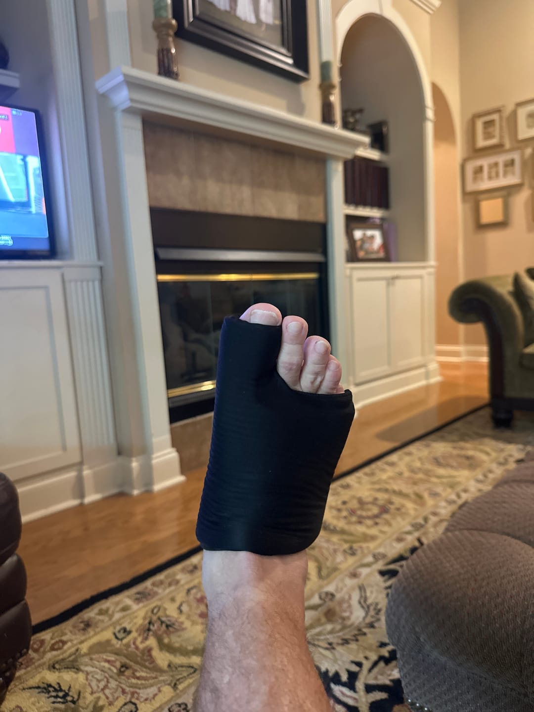 Customer photo review of Foot Brace
