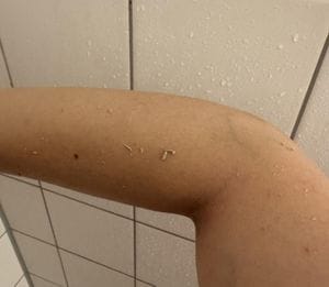 Customer photo review of SoftTouch™ – Peeling-Handschuh
