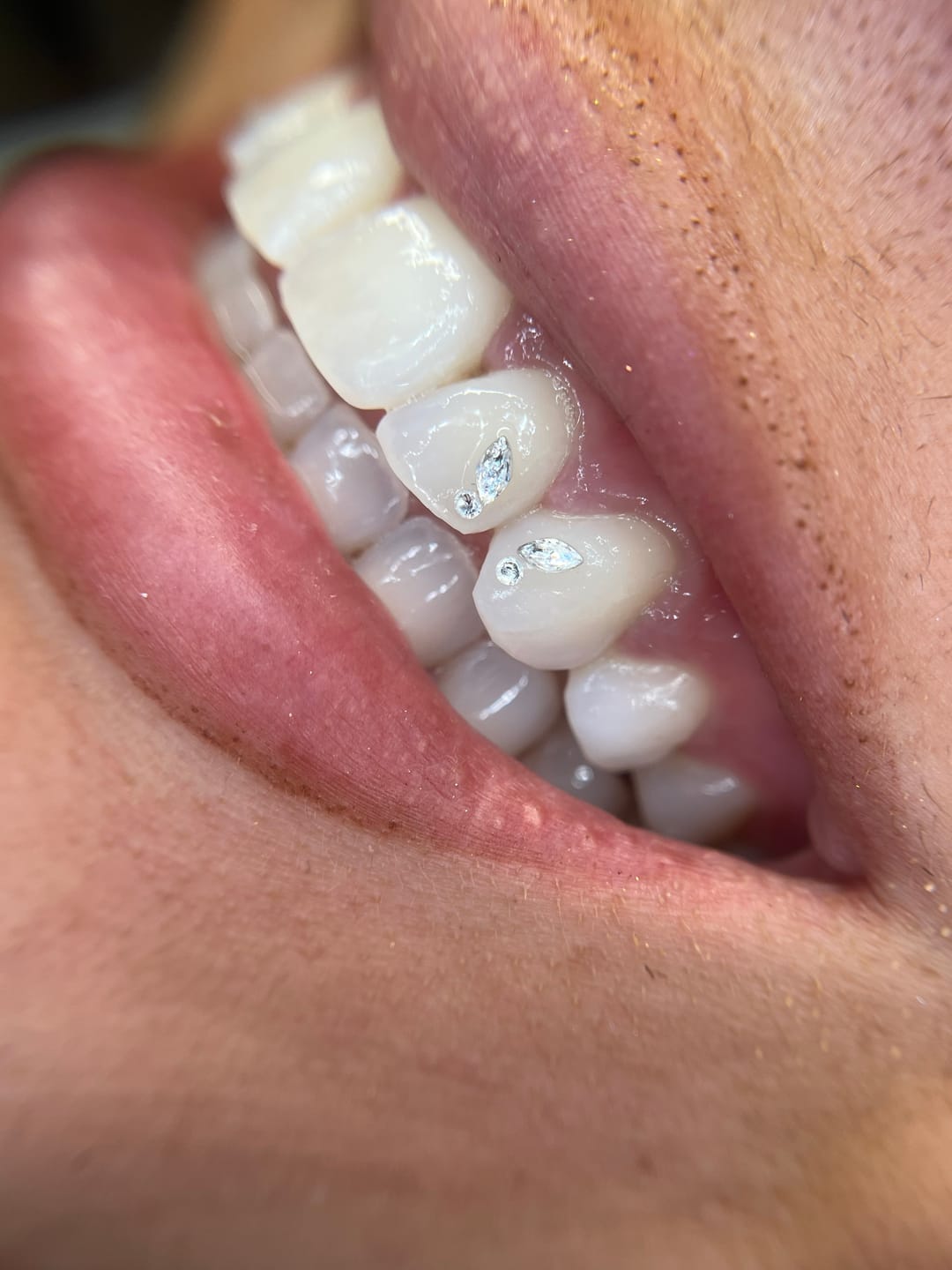 Customer photo review of Mini Marquise de Circonita cúbica - 10 unidades