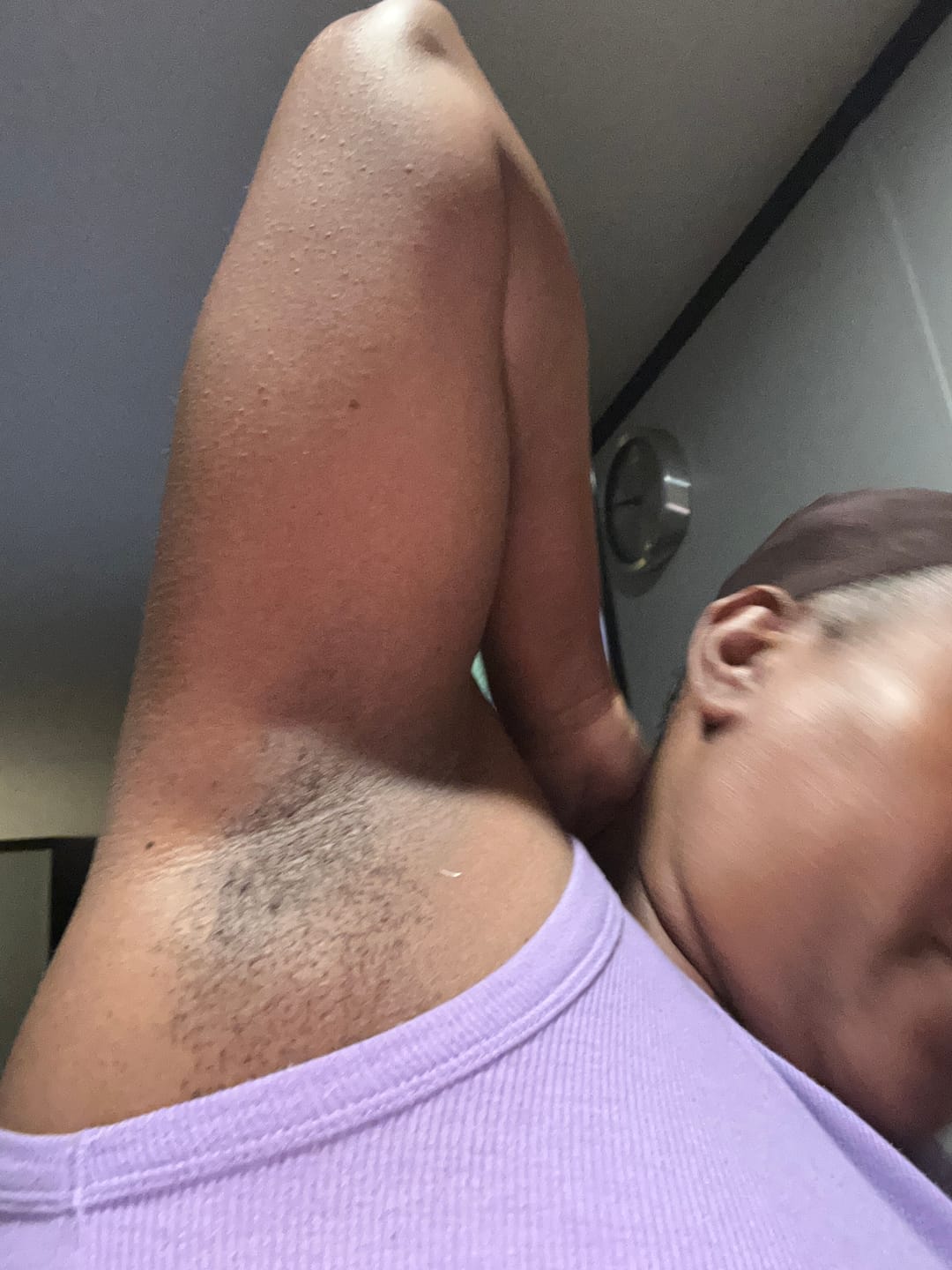 Customer photo review of Turmeric Dark Spot Removal Scrub