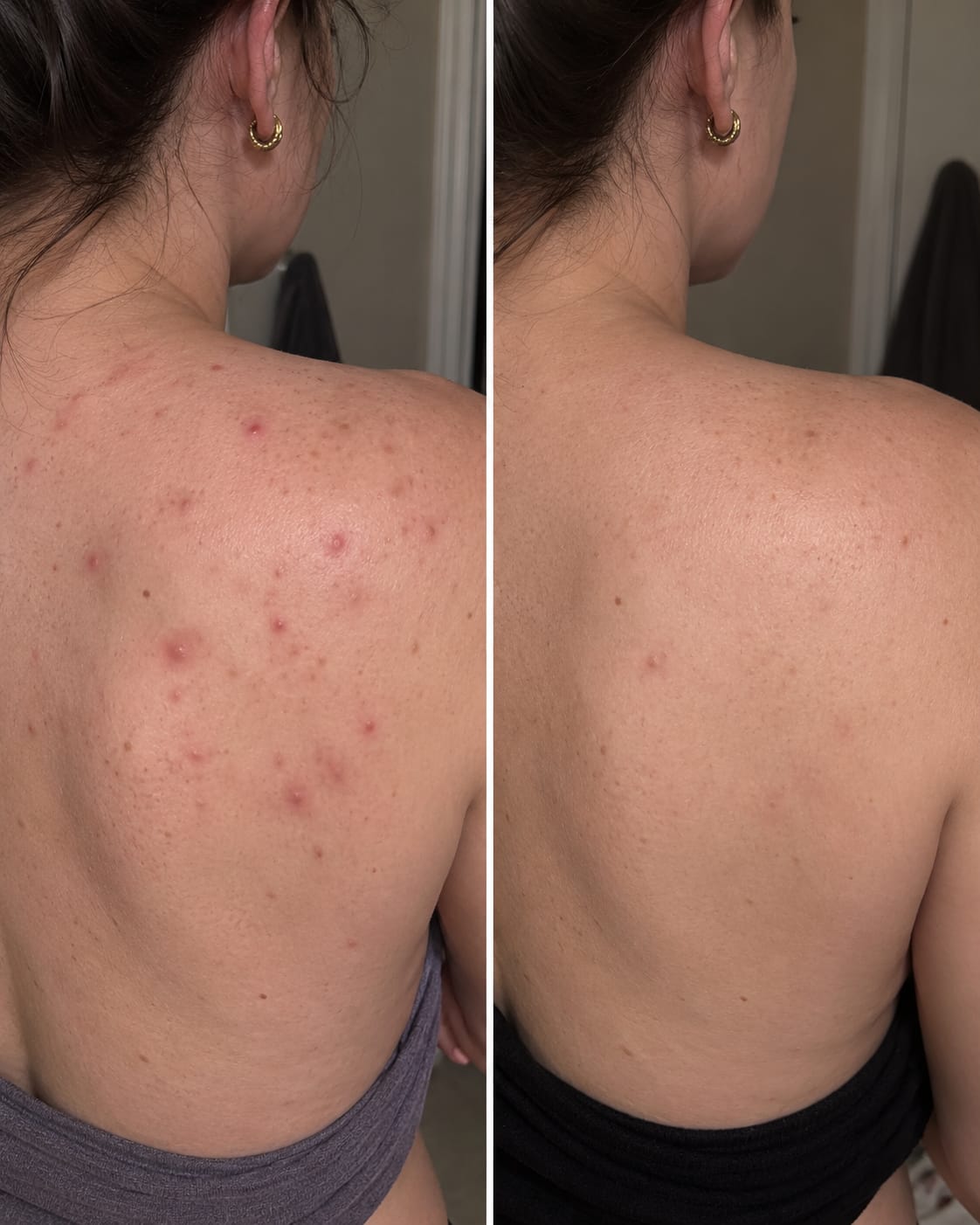 Customer photo review of NuvoDreams™ Skin & Hair Purifier