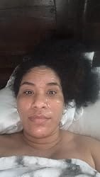 Customer photo review of CollaVeil™ Overnight Mask