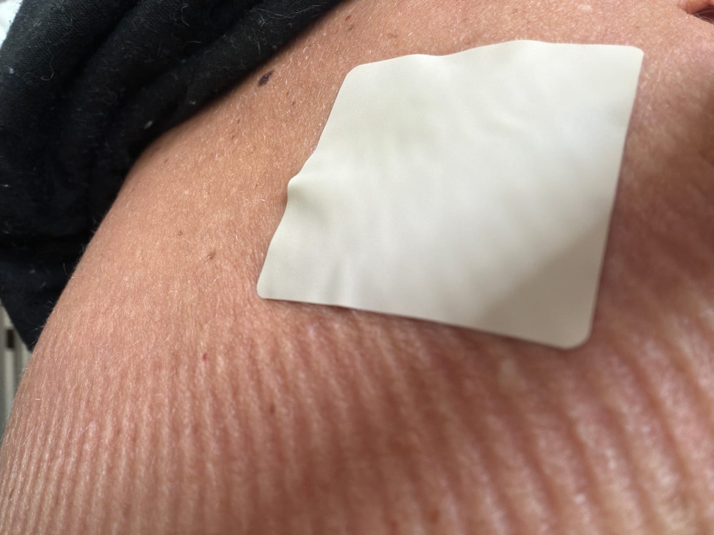 Customer photo review of mussage 8 Hour Sleep Patch