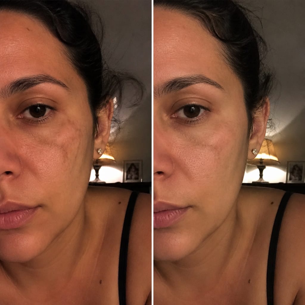 Customer photo review of Miyo - Retinal Shot