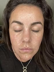 Customer photo review of CollaVeil™ Overnight Mask