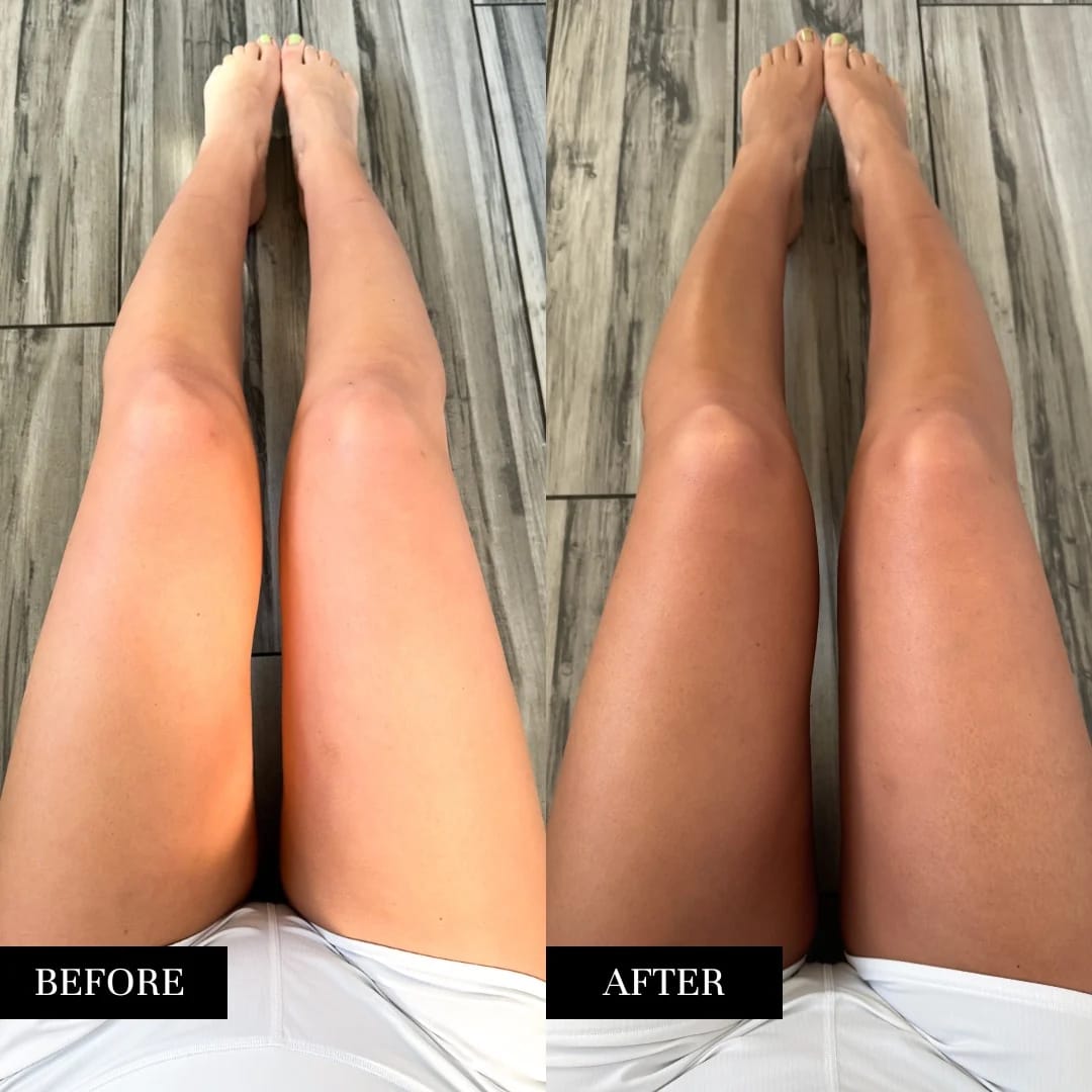 Customer photo review of Natural Self Tanner Set