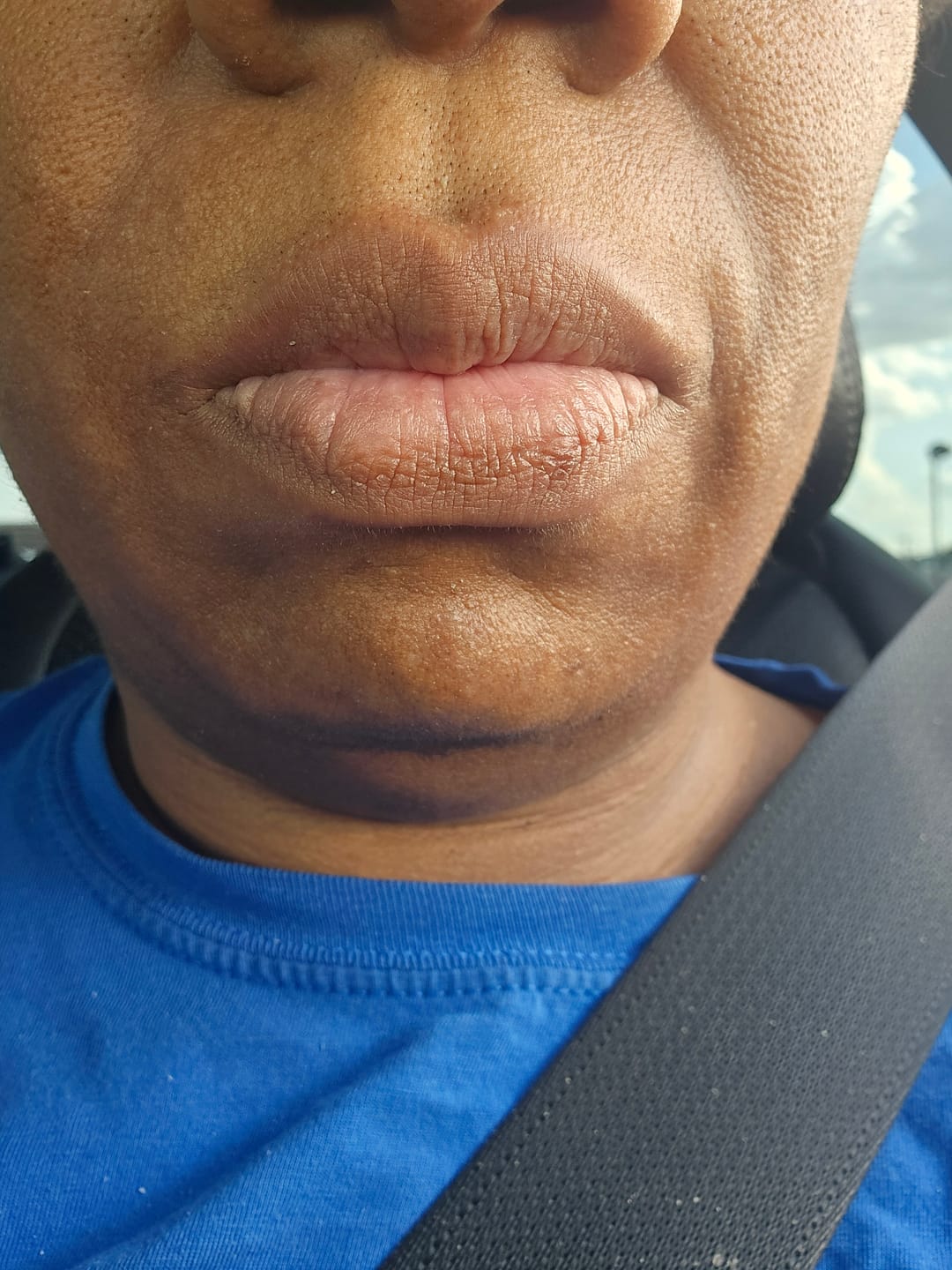 Customer photo review of Melanin Skin Bundle