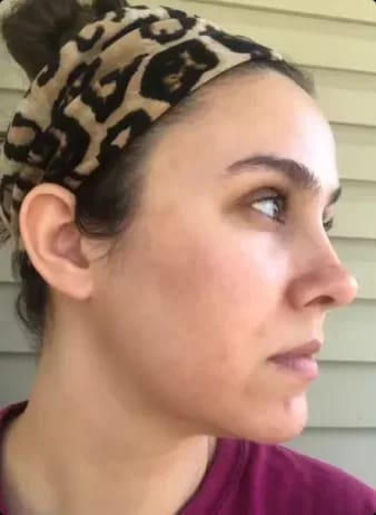 Customer photo review of YUNAE™ Post-Blemish Body Bar