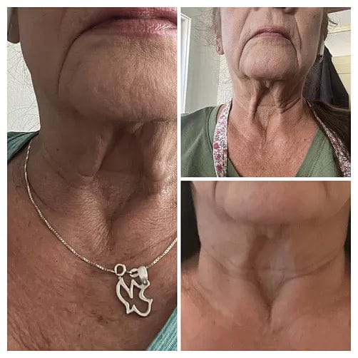 Customer photo review of קרם לצוואר רפוי וקמטוטים - למראה מתוח, מוצק וצעיר יותר