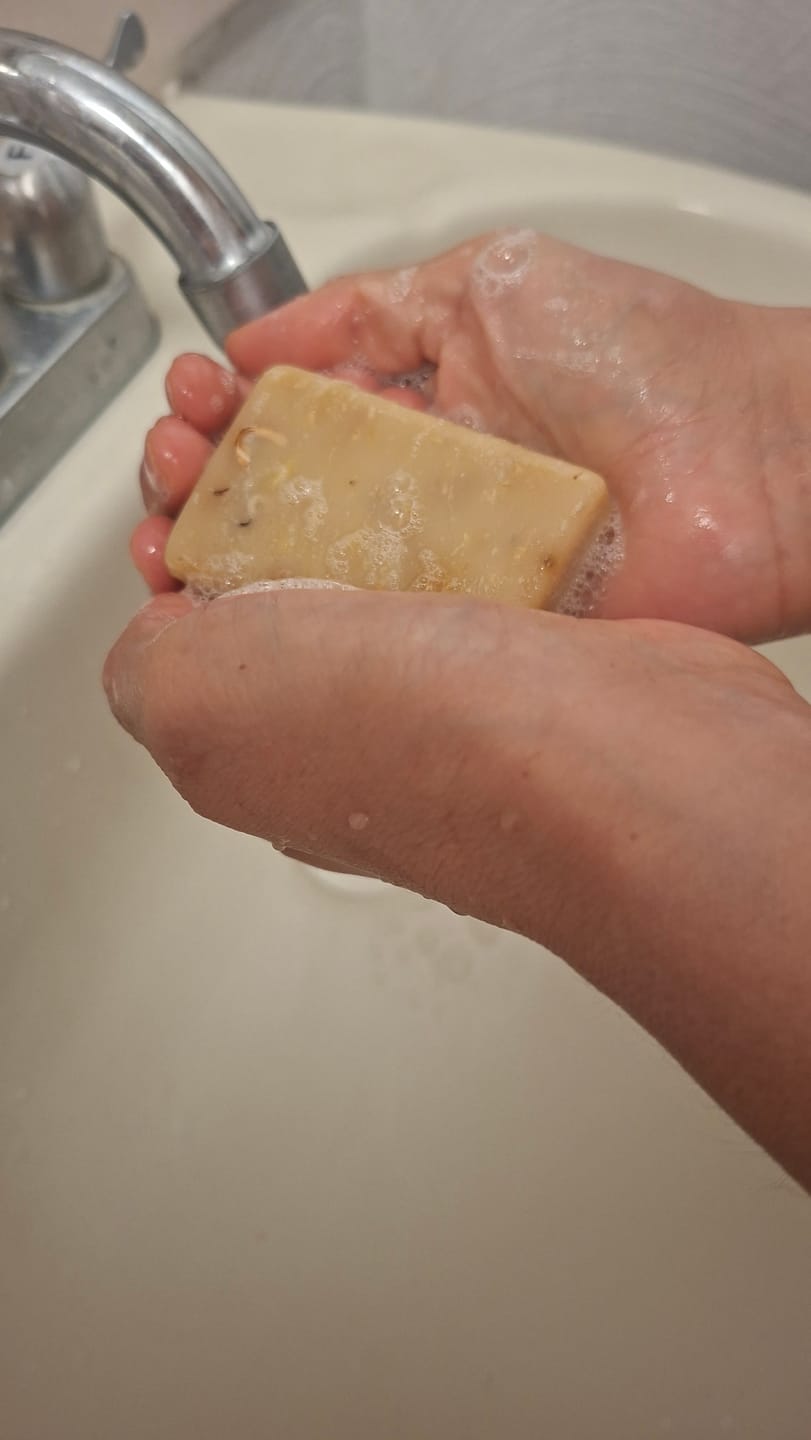 Customer photo review of 3 Pack - Jabones Faciales