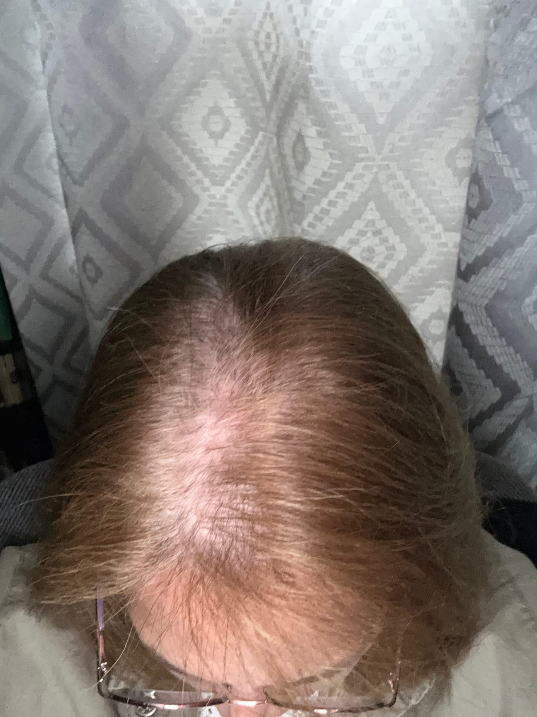 Customer photo review of Instant Dye Shampoo