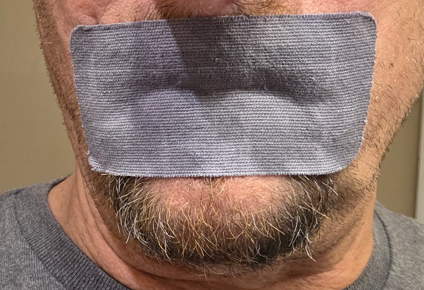 Customer photo review of ZzzTape - Mouth Tape
