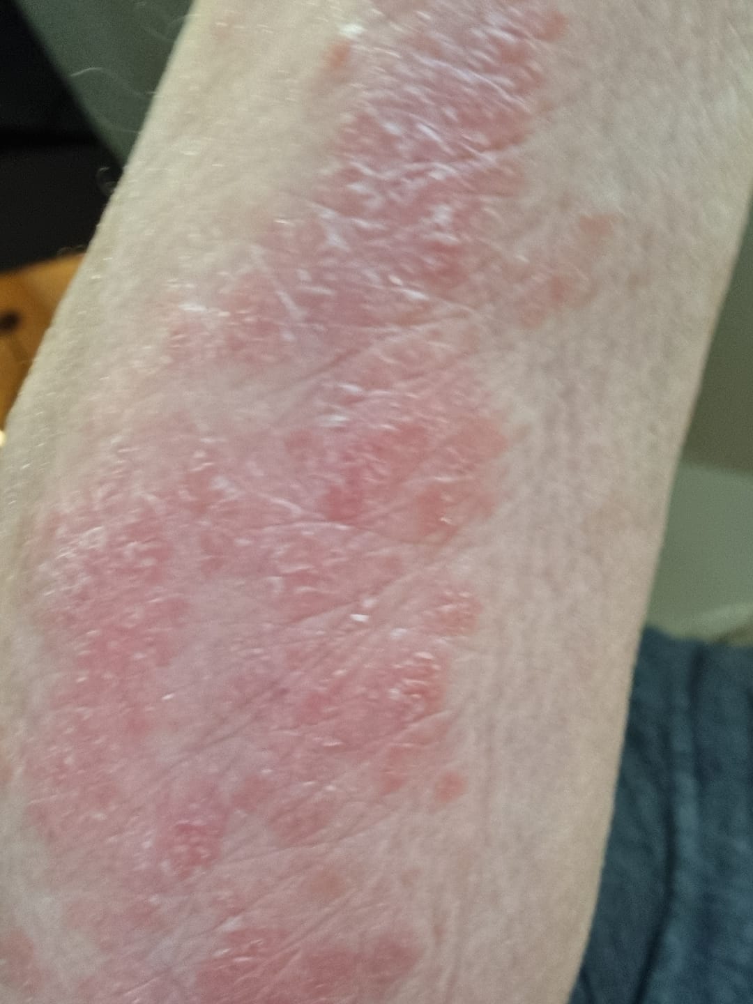Customer photo review of Multi Strain Biotic