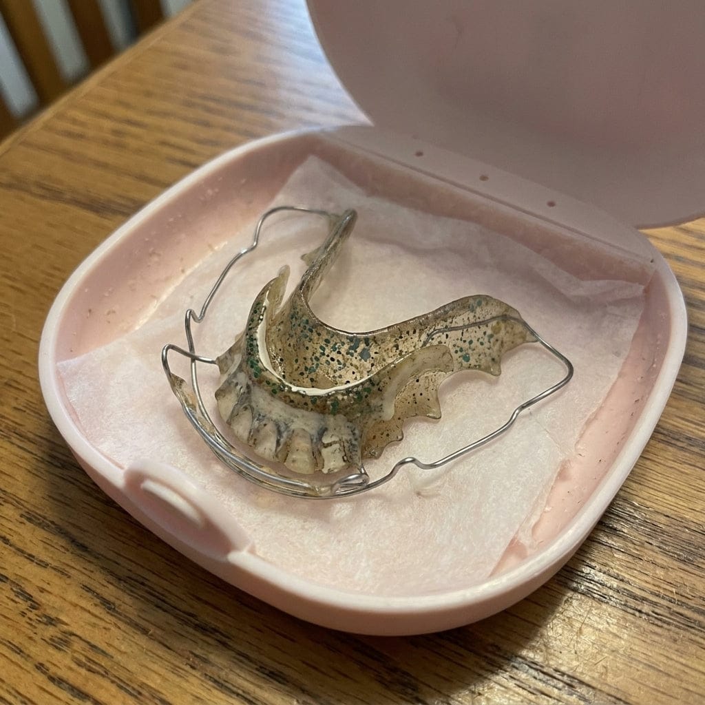 Customer photo review of Sterismile