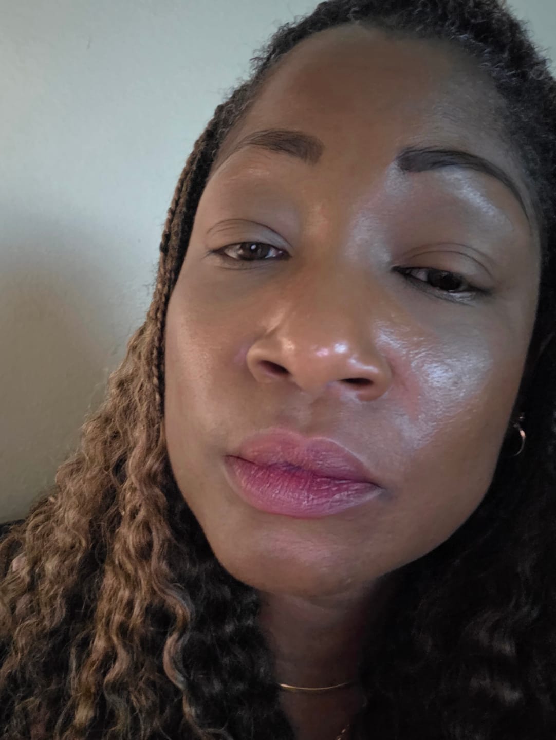 Customer photo review of Lips Lightening Cream For Men and Women (Results in 5 Days or Less)