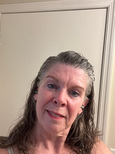 Reviewer's skin after using the Seranova Micro Infusion System for six months.