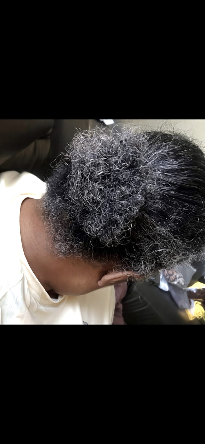 Customer photo review of Scalp Moisturizing Leave-In Treatment