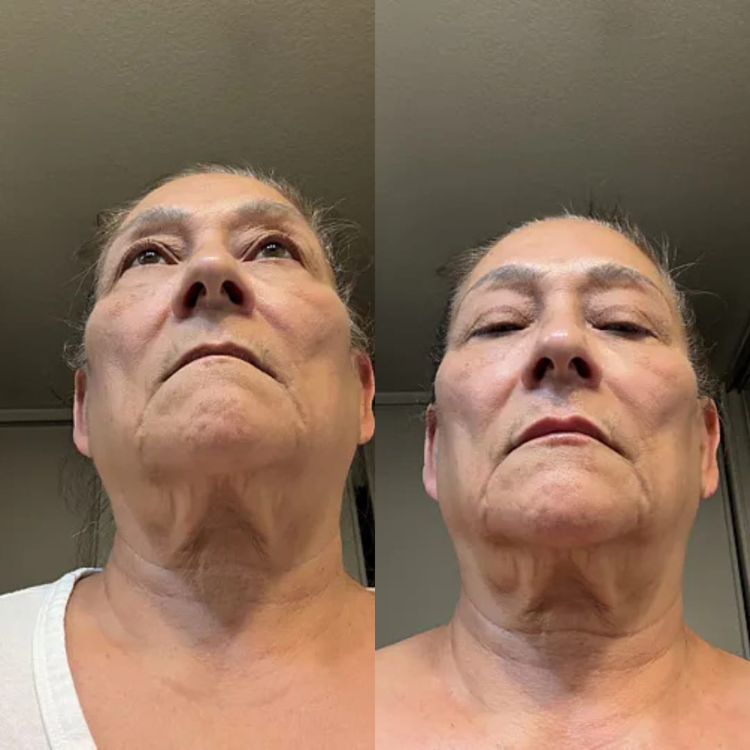 Customer photo review of קרם לצוואר רפוי וקמטוטים - למראה מתוח, מוצק וצעיר יותר